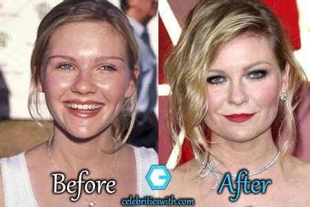 kirsten dunst boobs|The Strange Case of the Disappearing Nipples, or, Why。